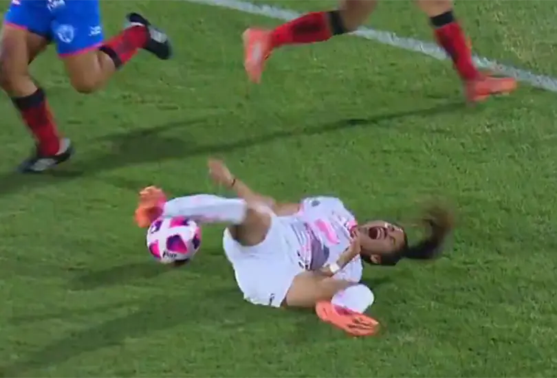 Katia Estrada, jugadora de Santos, sufre terrible lesión en el codo Katia Estrada, jugadora de Santos, sufre terrible lesión en el codo