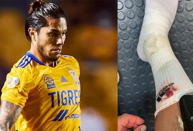Salcedo muestra herida en la espinilla; desata comentarios entre aficionados