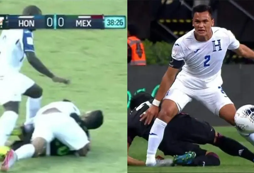 Las lesiones que han marcado los partidos entre M&eacute;xico y Honduras