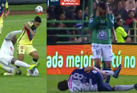 Chucho Lopez y otras lesiones de peroné en el futbol mexicano Chucho Lopez y otras lesiones de peroné en el futbol mexicano