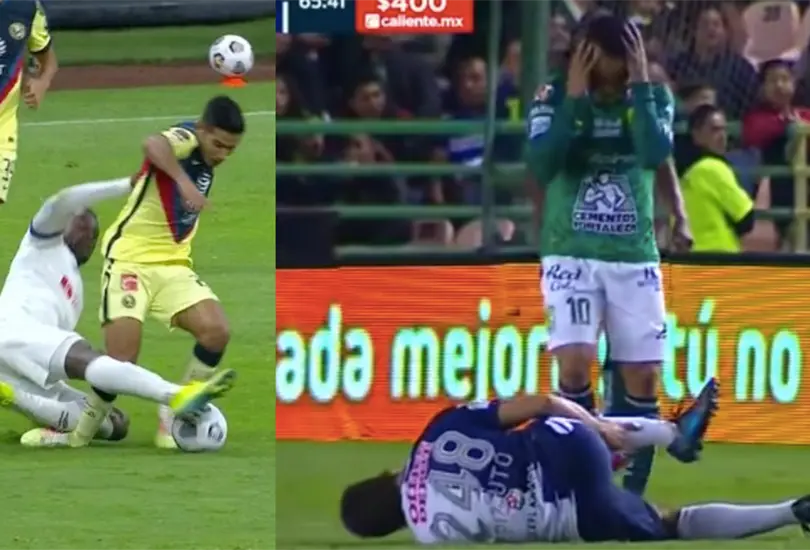 Chucho Lopez y otras lesiones de peron&eacute; en el futbol mexicano