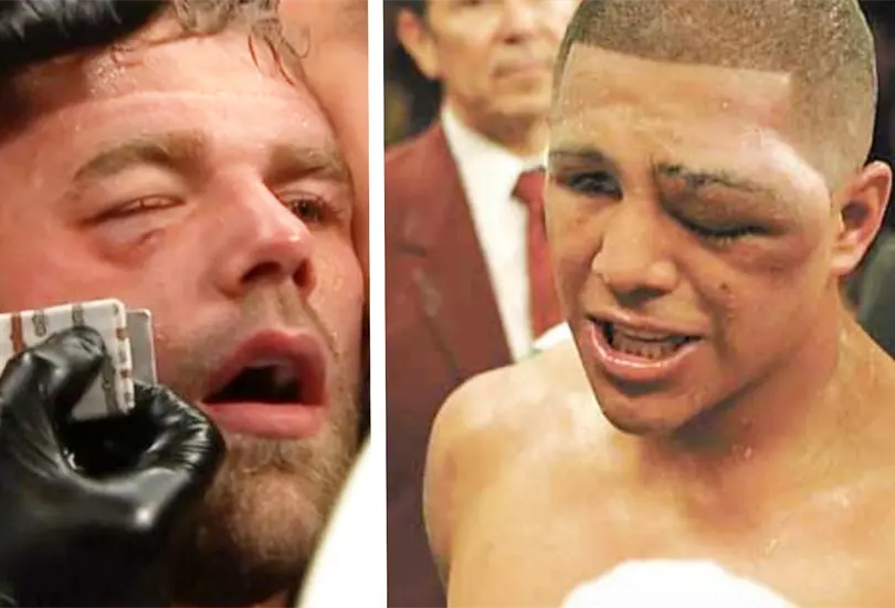Eres una verg&uuml;enza, no eres un hombre, excampe&oacute;n tunde a Saunders tras rendirse ante Canelo