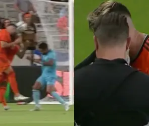 Herrera sufre cortada en aparatoso choque de cabezas en la derrota del Dynamo