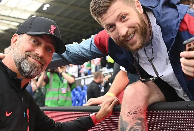 J&uuml;rgen Klopp pas&oacute; un momento divertido previo al arranque del partido ante el Manchester City.