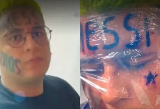 El colombiano que se tatuó el nombre de Messi en la frente reveló los motivos por los que se atrevió a hacerlo. El colombiano que se tatuó el nombre de Messi en la frente reveló los motivos por los que se atrevió a hacerlo.