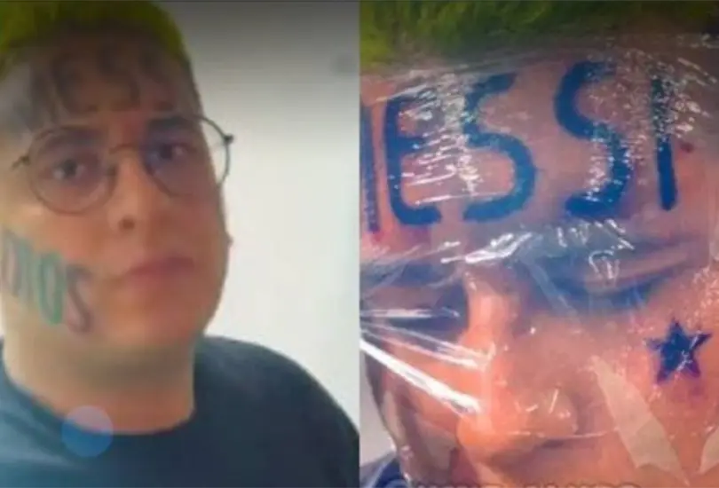 El colombiano que se tatu&oacute; el nombre de Messi en la frente revel&oacute; los motivos por los que se atrevi&oacute; a hacerlo.
