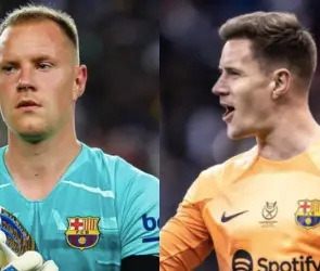 La exorbitante cantidad que se paga por un injerto de cabello; ¿cómo es el procedimiento?