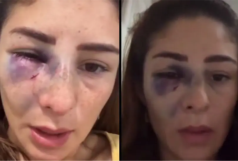 La exseleccionada nacional de lucha no dud&oacute; en hacer un llamado en redes sociales para atrapar a su agresor.