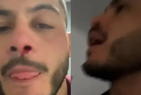 Marco Beltrán denunció a su expareja de abuso físico.