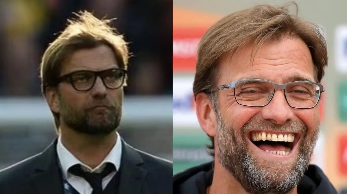 J&Uuml;RGEN KLOPP. El entrenador alem&aacute;n reconoci&oacute; p&uacute;blicamente que se injert&oacute; cabello, esto durante su etapa con el Borussia Dortmund en 2013. Fue para Diario Bild donde el estratega admiti&oacute; que hab&iacute;a recurrido al tratamiento capilar para evitar la calvicie "S&iacute;, me he trasplantado cabello. El resultado ha sido de lo mejor &iquest;eh?"