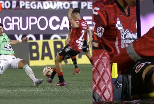 Carlos Valenzuela sufrió una escalofriante lesión en el partido entre Xolos y León.