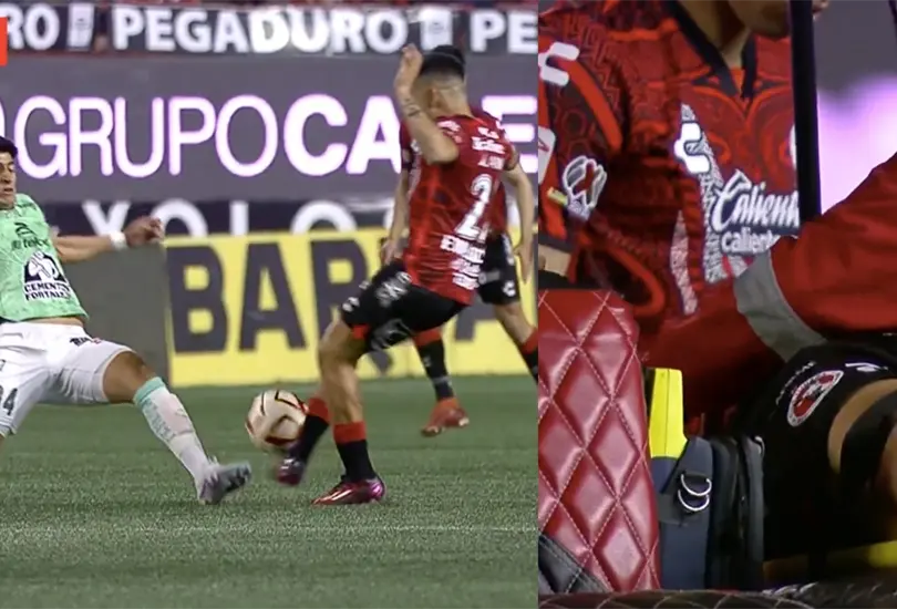 Carlos Valenzuela sufri&oacute; una escalofriante lesi&oacute;n en el partido entre Xolos y Le&oacute;n.
