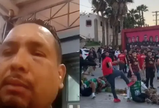 Enrique Cervantes fue la persona agredida por un encapuchado de Tijuana