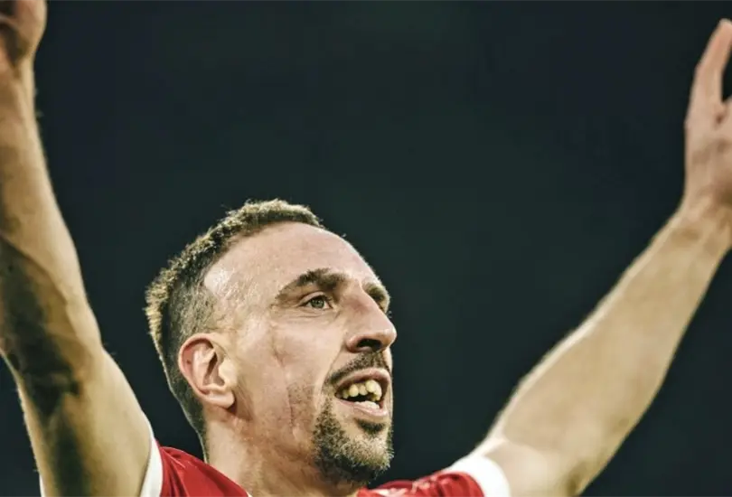 Franck Ribery us&oacute; su cicatriz como parte de su identidad y ahora es uno de los grandes &iacute;dolos del futboo mundial. 
