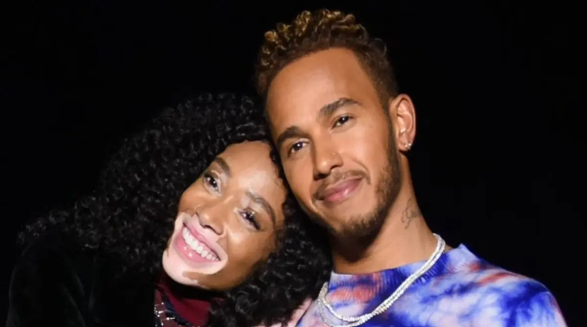 La modelo Winnie Harlow comparti&oacute; hace algunos a&ntilde;os fotograf&iacute;as donde se le ve&iacute;a muy de cerca con el ingl&eacute;s, y aunque los rumores de su noviazgo siempre estuvieron presentes, ambos dijeron que solo eran amigos.