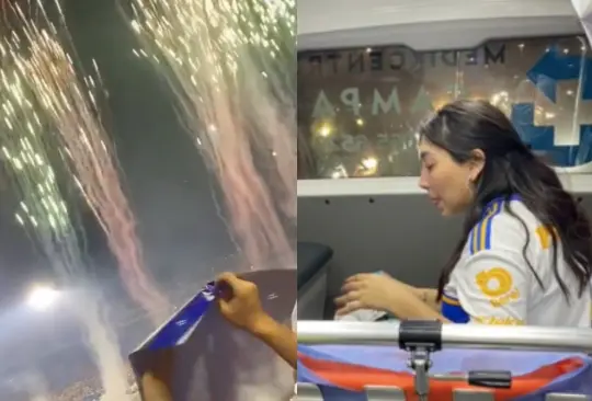 Una aficionada fue víctima de la pirotecnia del Estadio Universitario. Una aficionada fue víctima de la pirotecnia del Estadio Universitario.
