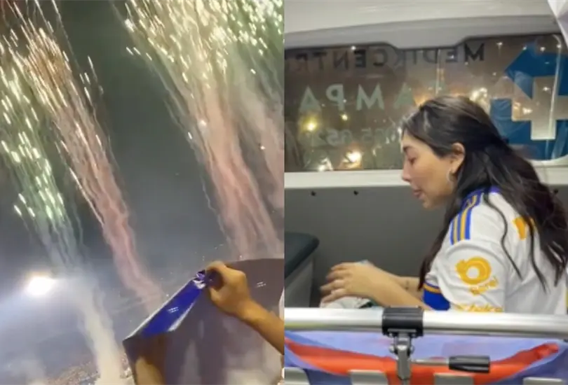 Una aficionada fue v&iacute;ctima de la pirotecnia del Estadio Universitario.