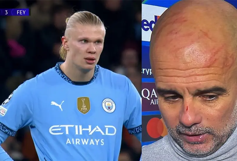 Pep Guardiola apareci&oacute; en el post-partido con varios rasgu&ntilde;os.