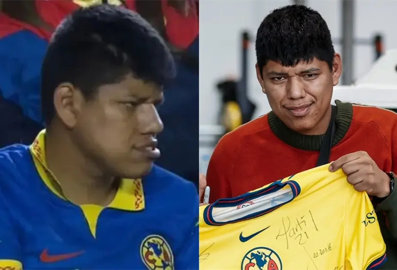 El América compensó al aficionado conocido como Bebote. El América compensó al aficionado conocido como Bebote.
