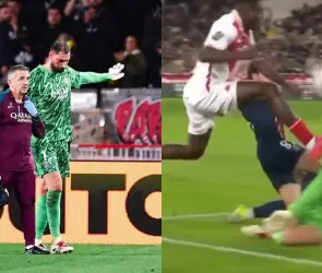 Así quedó Donnarumma tras el brutal pisotón que recibió en la cara (FOTOS)