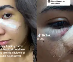 Fan de Nicki Nicole confiesa recibir un botellazo de ella durante uno de sus conciertos (FOTOS)