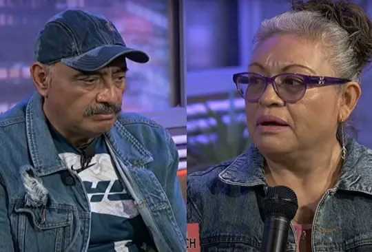 Don Beto habló al respecto de los quemones que ha sufrido. Don Beto habló al respecto de los quemones que ha sufrido.