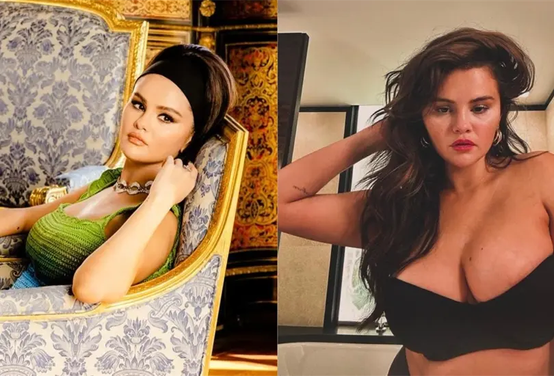 Selena Gomez ha llamado la atenci&oacute;n por su radical cambio f&iacute;sico a lo largo de los &uacute;ltimos a&ntilde;os.