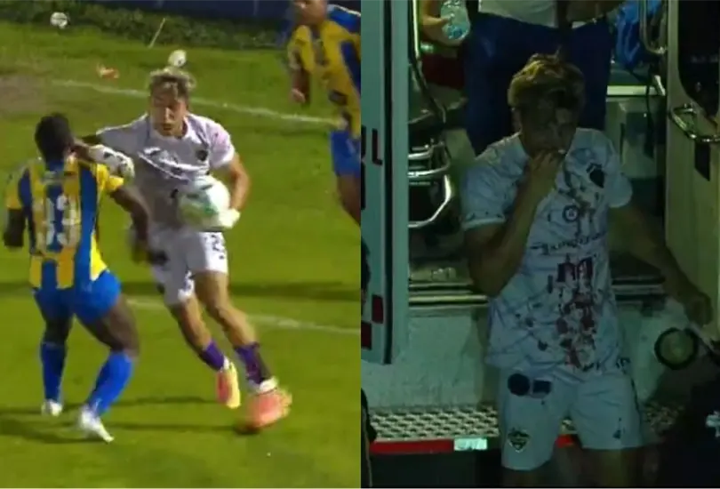 El guardameta que agredi&oacute; a un rival no sali&oacute; bien parado de la situaci&oacute;n y termin&oacute; ensangrentado.