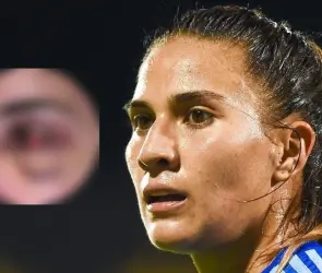 FOTOS | Nayeli Rangel muestra a detalle cómo quedó su ojo tras una semana de ser operada