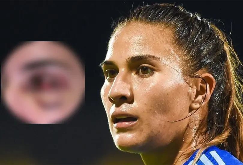 Nayeli Rangel mostr&oacute; detalles de su cirug&iacute;a.