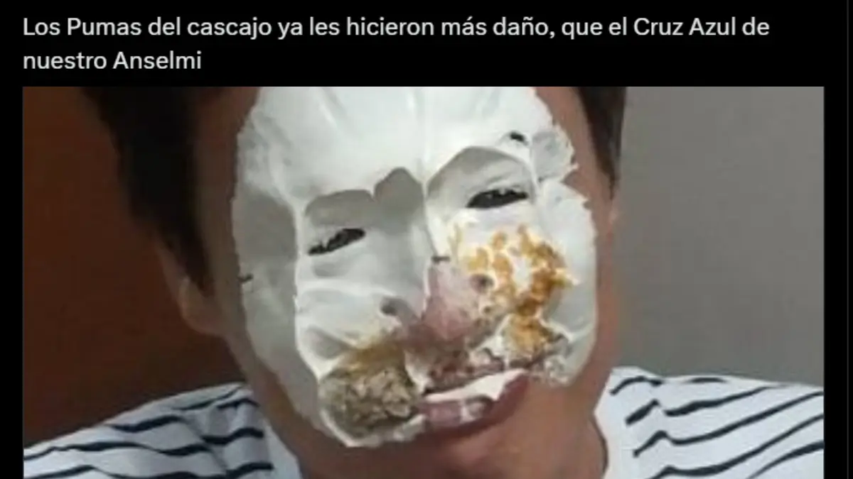 América es víctima de los memes tras caer sorpresivamente ante Pumas