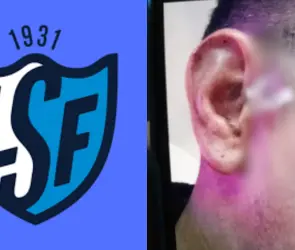 Futbolista agrede con cuchillo a su rival en pleno partido (FOTO)