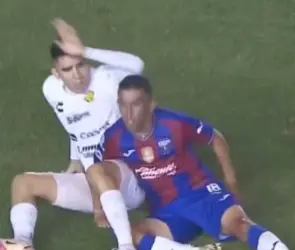 Hobbit Bermúdez: Así quedó la pierna del futbolista del Atlante tras escalofriante lesión (FOTOS)