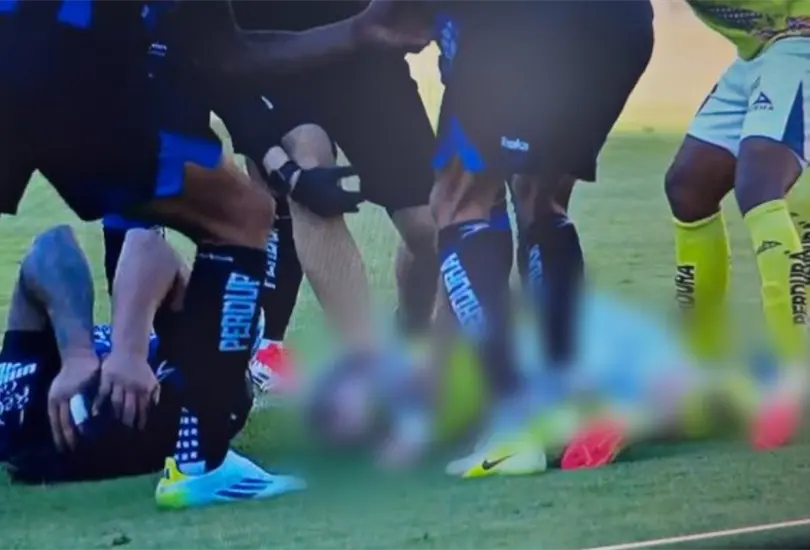 Emiliano Gómez sufrió un duro golpe en su cabeza el cual provocó que se convulsionara Emiliano Gómez sufrió un duro golpe en su cabeza el cual provocó que se convulsionara