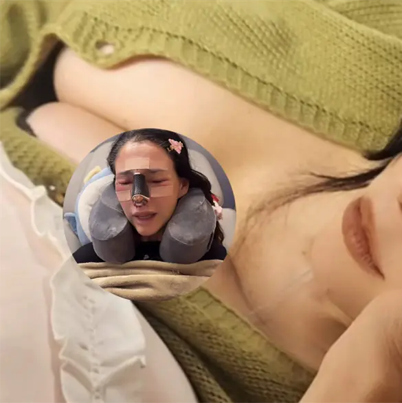 VIDEO: Dorismar sufre desfiguración facial tras cirugía estética VIDEO: Dorismar sufre desfiguración facial tras cirugía estética