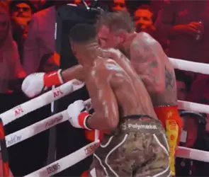 Jake Paul sufre doble fractura de mand&iacute;bula tras KO de Anthony Joshua