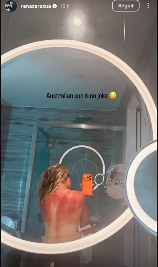 Renata Zaraz&uacute;a mostr&oacute; las consecuencias del sol australiano