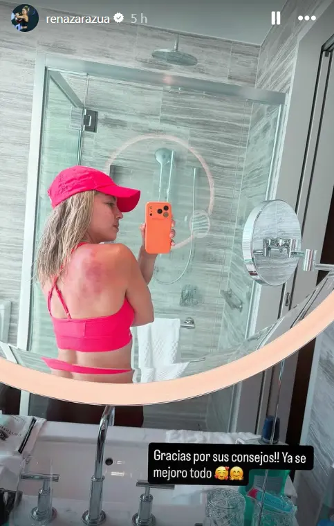 Actualizaci&oacute;n del estado de su espalda