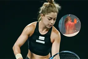 &iexcl;Brutal! Renata Zaraz&uacute;a muestra quemaduras por el sol en Australia