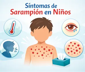 S&iacute;ntomas de sarampi&oacute;n en ni&ntilde;os: 5 se&ntilde;ales de alerta para padres