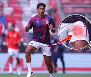 Luis Romo recae en su lesi&oacute;n y pone en riesgo su llamado al Tri