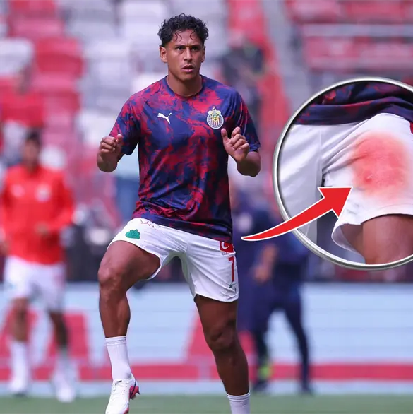 Luis Romo recae en su lesión y pone en riesgo su llamado al Tri