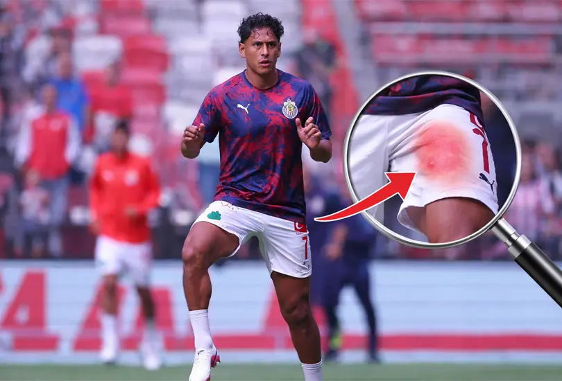 Luis Romo recae en su lesi&oacute;n y pone en riesgo su llamado al Tri