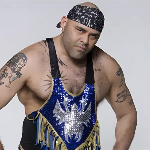 Konnan sufre amputaci&oacute;n de una pierna; enfrenta delicado estado de salud