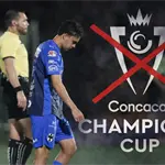 &iquest;Qu&eacute; tan grave es la lesi&oacute;n de Iker Fimbres? Ser&aacute; baja ante Cruz Azul