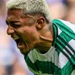 &iquest;Se pierde el Mundial? El tiempo que se perder&iacute;a Juli&aacute;n Araujo por lesi&oacute;n