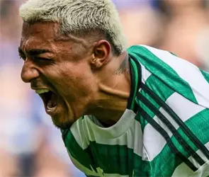 &iquest;Se pierde el Mundial? El tiempo que se perder&iacute;a Juli&aacute;n Araujo por lesi&oacute;n