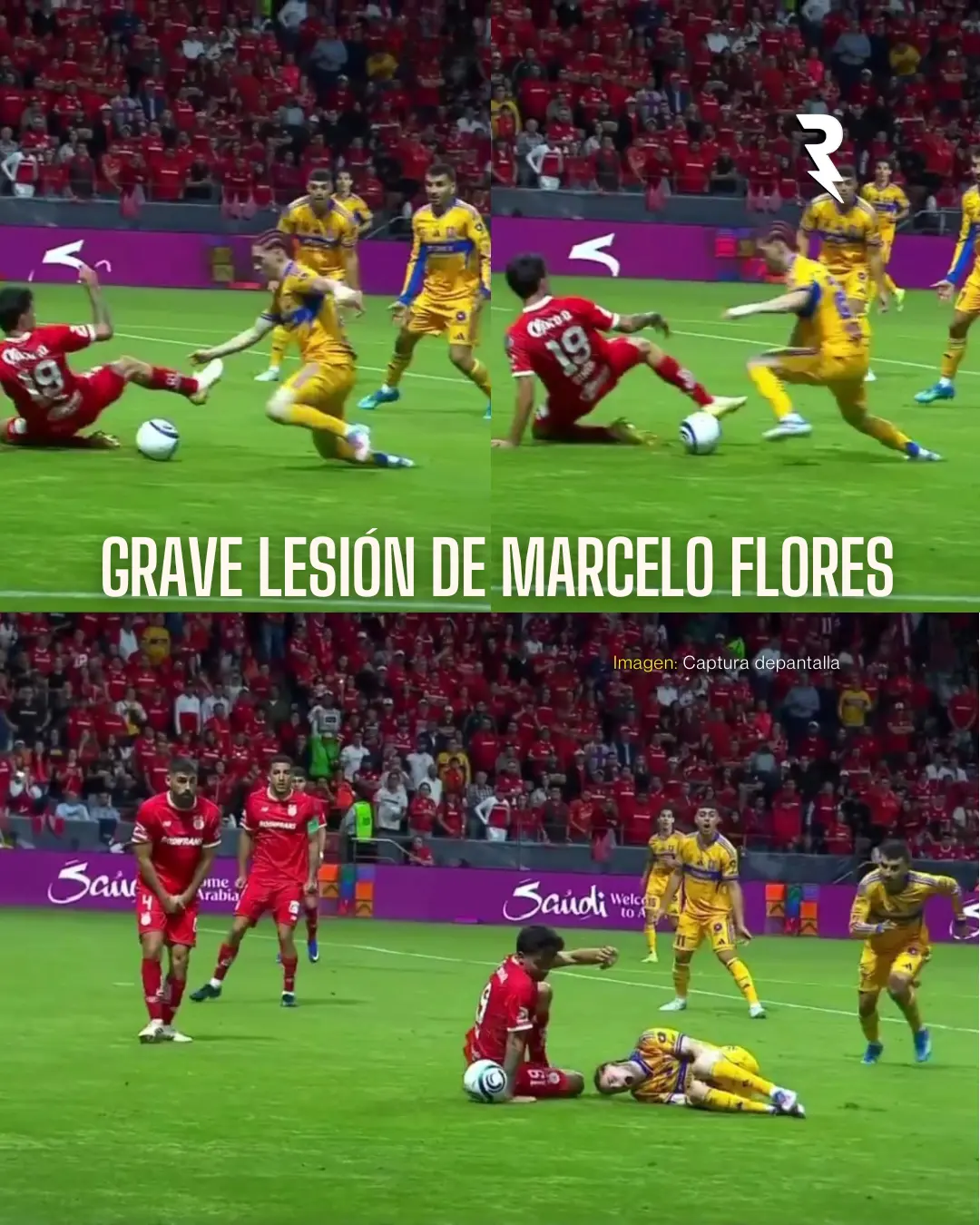 Grave lesión de Flores previo a su primer Mundial Grave lesión de Flores previo a su primer Mundial