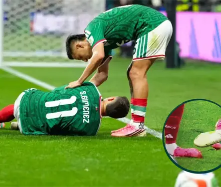 &iquest;Qu&eacute; tan grave es la lesi&oacute;n de Santiago Gim&eacute;nez?
