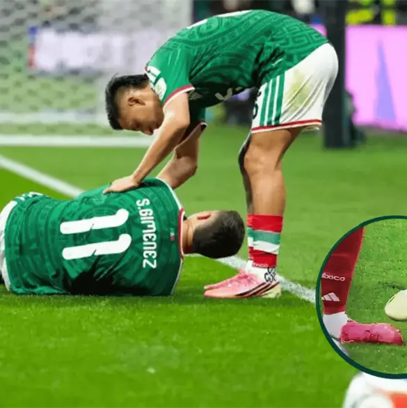 &iquest;Qu&eacute; tan grave es la lesi&oacute;n de Santiago Gim&eacute;nez?